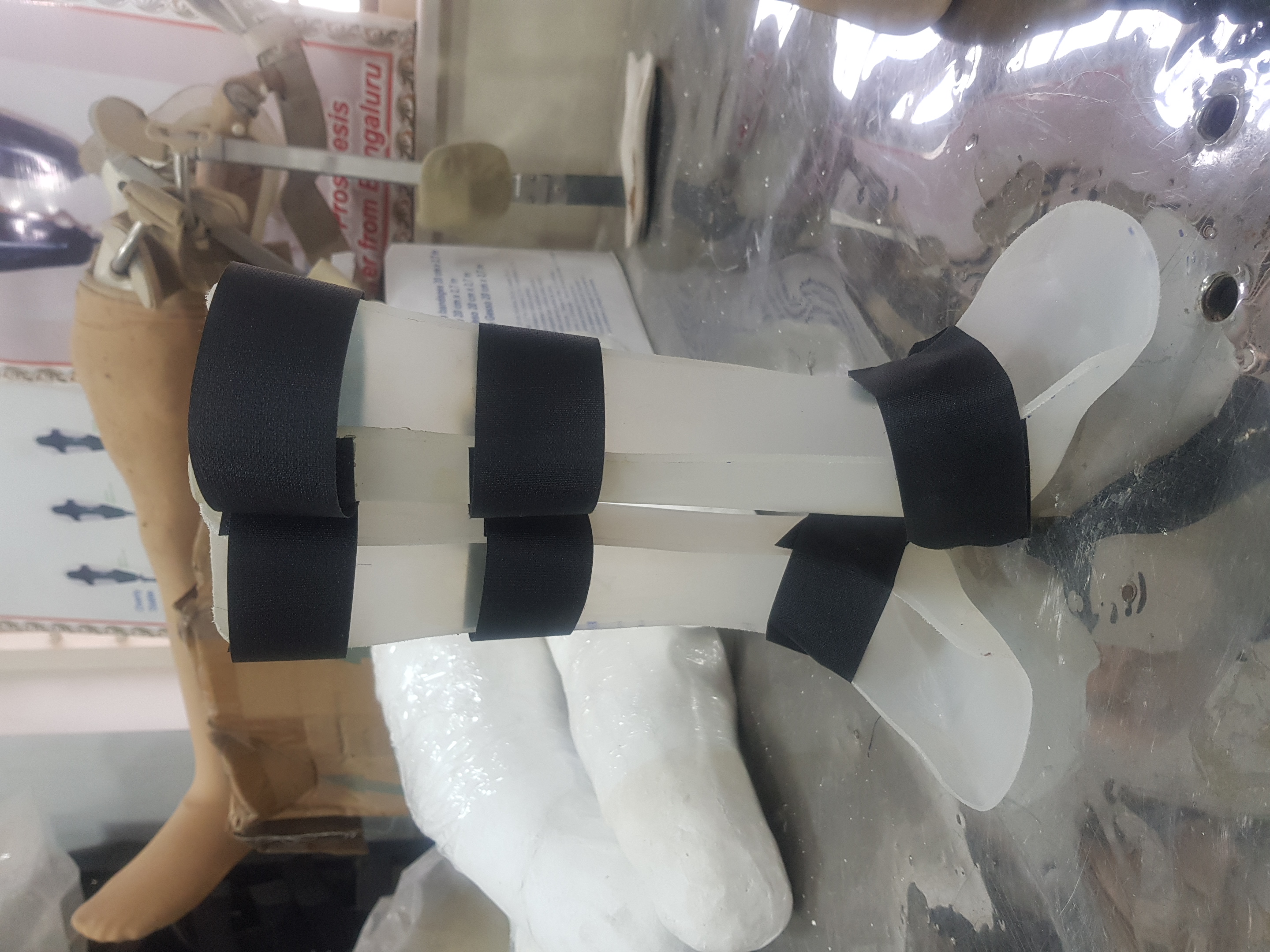 Custom orthotic fitting during camp