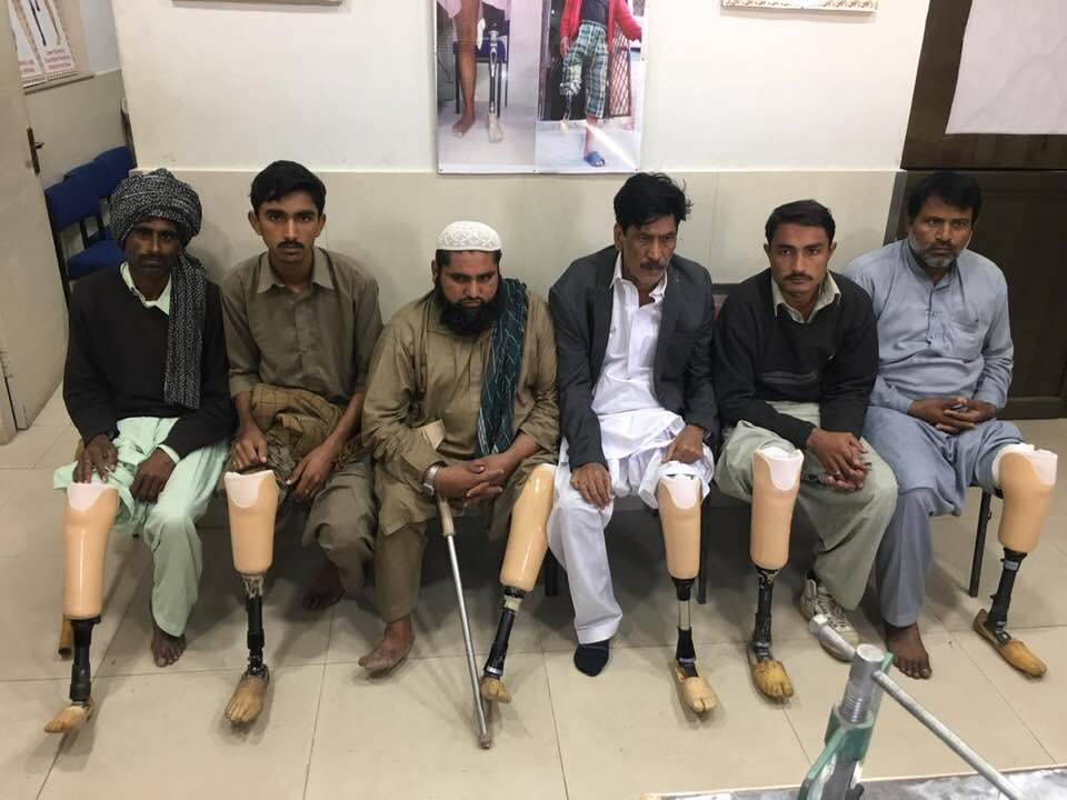 Transtibial amputees with transtibial prosthesis