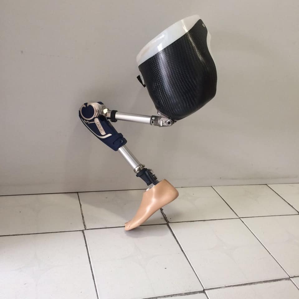 Hip Disarticulation Prosthesis