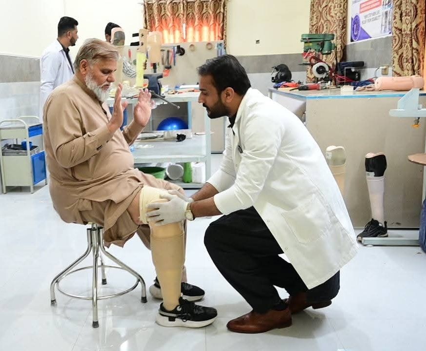 Transtibial Prosthesis