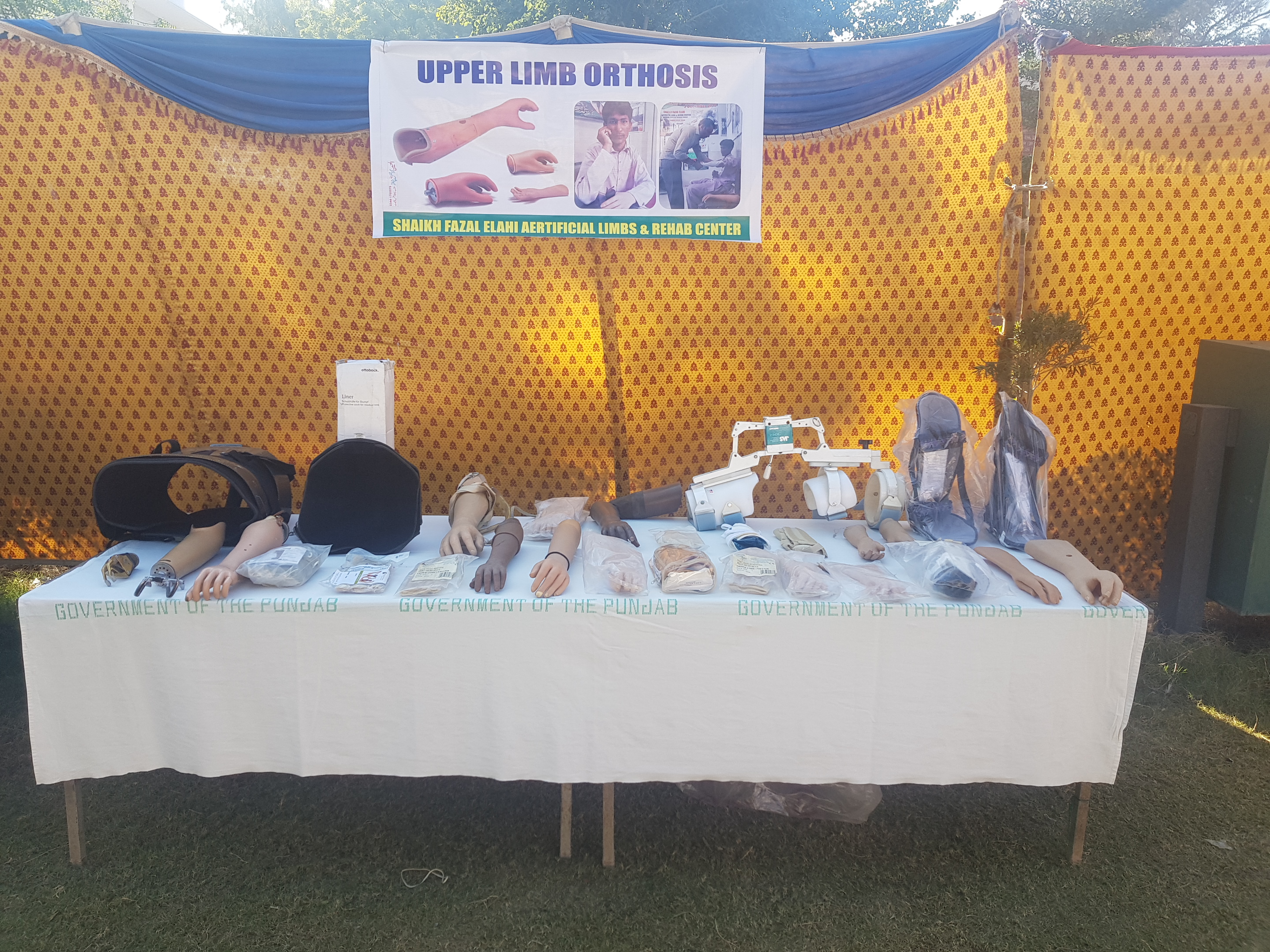 Upper Limb Prosthesis